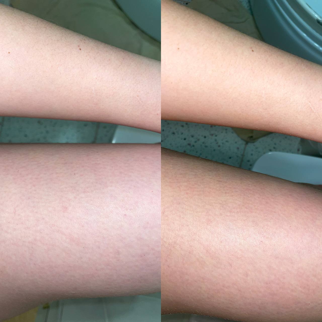 Это фото до и сразу после того, как